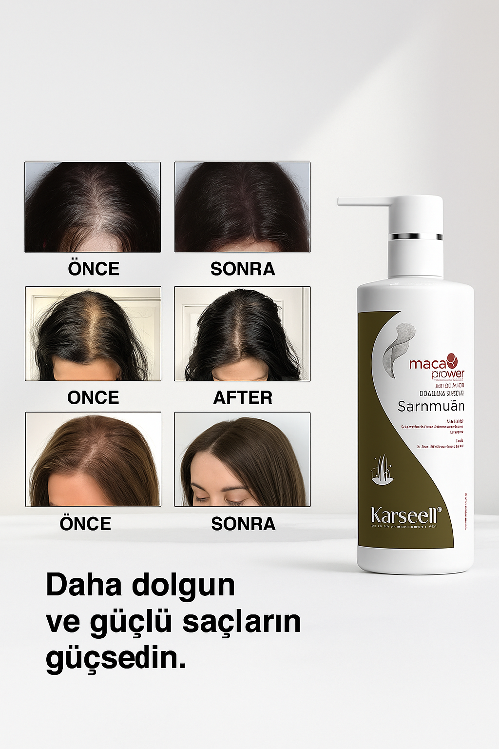 Karseell Dökülme Önleyici Şampuan 500 ml